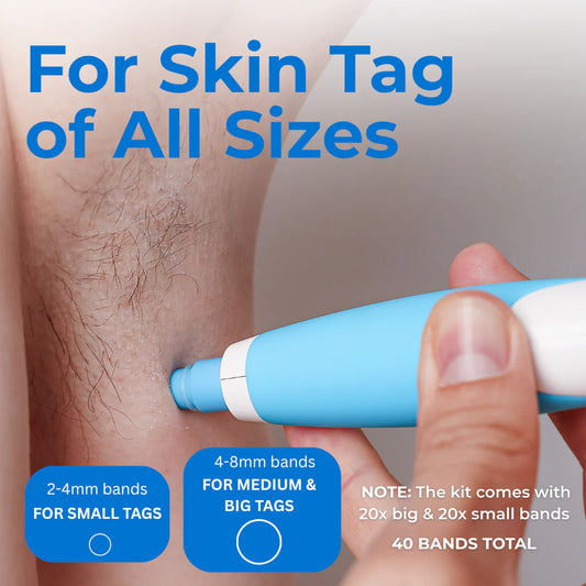 Skin Tag Remover Kit - (Painless)(2 in 1)